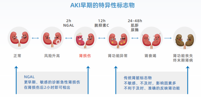 NGAL：中文(wén)名记不住，要记住这些临床价值